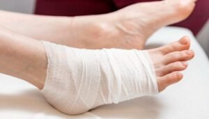 cara mengeringkan luka dengan cepat