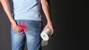 Penyebab Wasir: Ketika Pembuluh Darah di Area Dubur Mulai Membengkak